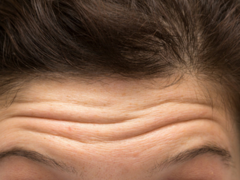 Why does skin wrinkle when it is exposed at length to water?